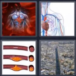 4 Fotos 1 Palabra Arteria